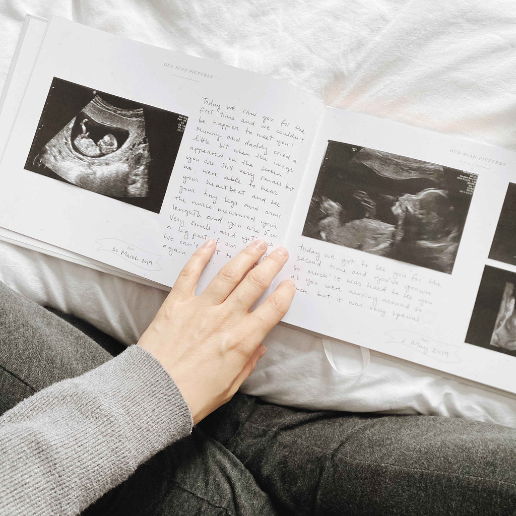 Open book with ultrasound images and handwritten text, held by a person.