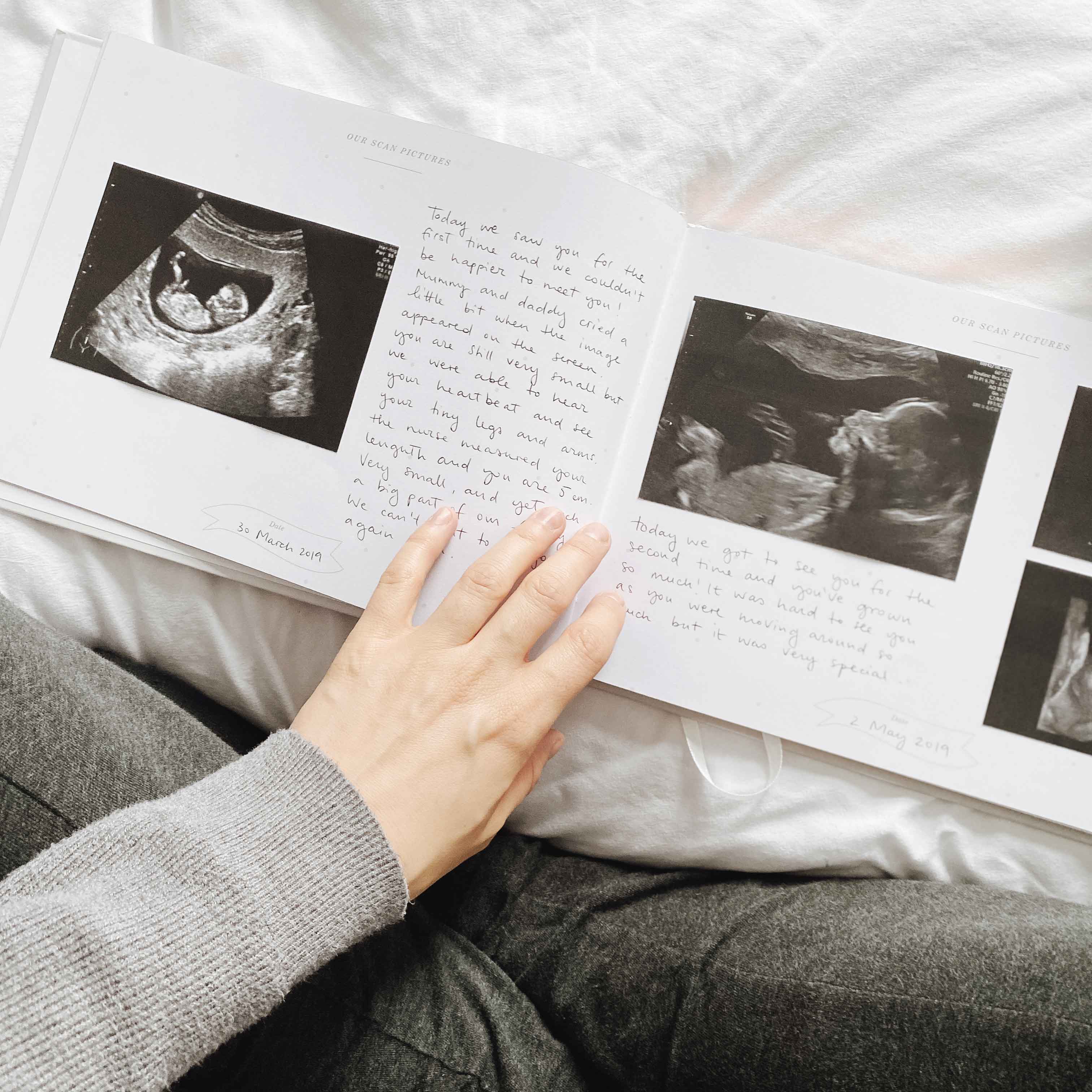 Open book with ultrasound images and handwritten text, held by a person.